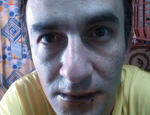 سعید پورحیدر با دوختن لب‌هایش دست به اعتصاب غذا زد